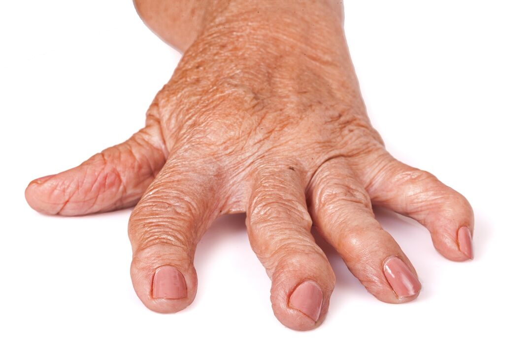 HondroFrost for joint pain