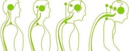 The cervical spine loses mobility